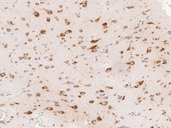 Sino Biological Anti-CDCA3 Antibody, Rabbit Polyclonal, Quantity: Each