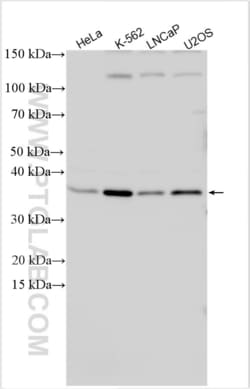 CDCA5 Rabbit, anti-Human, Polyclonal, Proteintech Quantity: 150 &mu;L:Antibodies