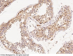 Sino Biological Anti-CDK3 Antibody, Rabbit Polyclonal, Quantity: Each of