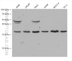 CDK5 Mouse, anti-Human, Clone: 1B9E1, Proteintech Quantity: 20 &mu;L:Antibodies