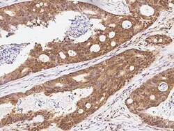 Sino Biological Anti-Cdk6 Antibody, Rabbit Polyclonal, Quantity: Each of