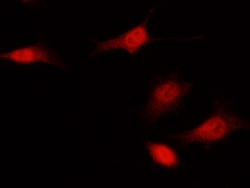 Sino Biological Anti-CDKN2A/p16INK4a Antibody, Rabbit Polyclonal, Quantity: