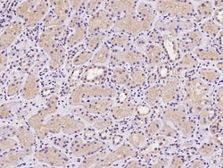 Sino Biological CDKN2AIPNL Antibody, Rabbit PAb, Antigen Affinity Purified