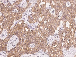 Sino Biological CDO/CDON Antibody, Rabbit PAb, Antigen Affinity Purified