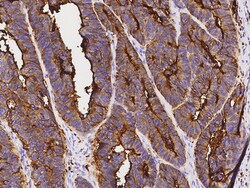 Sino Biological CEACAM3/CD66d Antibody, Rabbit PAb, Antigen Affinity Purified