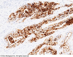 Sino Biological CEACAM5 / CD66e Antibody, Rabbit MAb 100uL, Quantity: Each