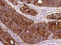 Sino Biological CEACAM6/CD66c Antibody, Rabbit PAb, Antigen Affinity Purified