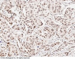 Sino Biological CHD4 Antibody, Rabbit PAb, Antigen Affinity Purified 100uL,