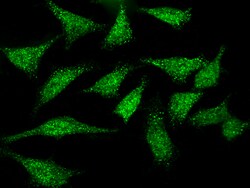Sino Biological Anti-Chk1 Antibody, Rabbit Polyclonal, Quantity: Each of
