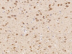 Sino Biological Anti-CHRNA7 Antibody, Rabbit Polyclonal, Quantity: Each