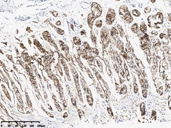 Sino Biological Claudin 18 Antibody, Mouse MAb 20uL, Quantity: Each of