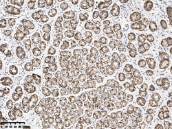 Sino Biological Claudin 18 Antibody, Rabbit MAb 100uL, Quantity: Each of