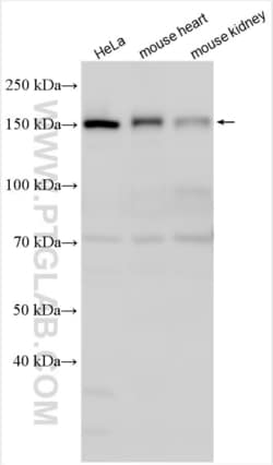 CLUH Rabbit, anti-Human, Polyclonal, Proteintech Quantity: 150 &mu;L:Antibodies