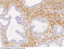 Sino Biological CNN1 Antibody, Rabbit PAb, Antigen Affinity Purified 100uL,