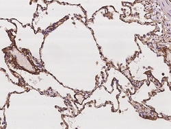 Sino Biological Collagen VIII alpha 1/COL8A1 Antibody, Rabbit PAb, Antigen