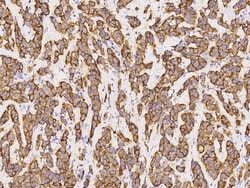 Sino Biological COL9A1 Antibody, Rabbit PAb, Antigen Affinity Purified
