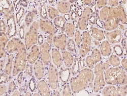 Sino Biological COMMD1/MURR1 Antibody, Rabbit PAb, Antigen Affinity Purified