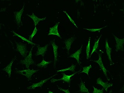 Sino Biological COMMD9 Antibody, Mouse MAb 100µL, Quantity: Each of 1