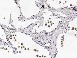 Sino Biological COMMD9 Antibody, Rabbit MAb 100µL, Quantity: Each of 1