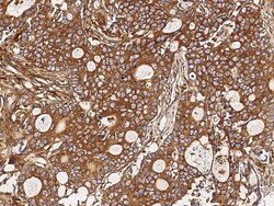Sino Biological CORO2A Antibody, Rabbit PAb, Antigen Affinity Purified