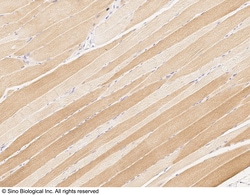Sino Biological Anti-CPT2 Antibody, Rabbit Polyclonal, Quantity: Each of