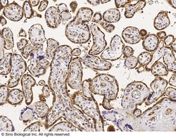 Sino Biological CRIP2 Antibody, Rabbit PAb, Antigen Affinity Purified 100uL,