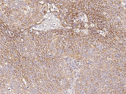 Sino Biological Anti-IL-3R Beta/IL3RB Antibody, Rabbit Polyclonal, Quantity: