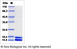 Sino Biological Human S100A8 & S100A9 Heterodimer Protein 1mg, Quantity: