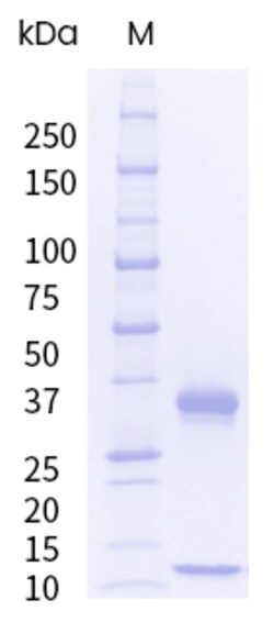 Sino Biological&nbsp;Recombinant Human FCGRT & B2M Heterodimer Protein (His Tag), HPLC-verified, Endotoxin-Free