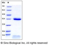Sino Biological Human FCGRT & B2M Heterodimer Protein (His Tag) 1mg, Quantity: