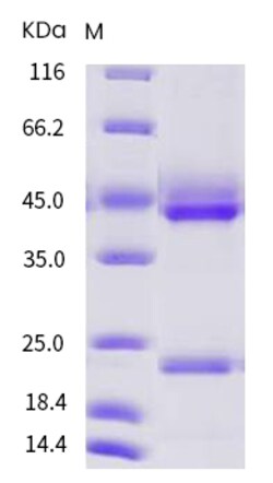 Sino Biological Recombinant Human IL-23 Protein (His Tag), Quantity: Each