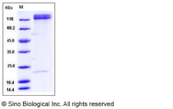 Sino Biological Recombinant Human Integrin alpha 5 beta 1 Protein (Flag