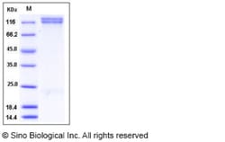 Sino Biological Recombinant Human Integrin alpha 8 beta 1 Protein (Flag