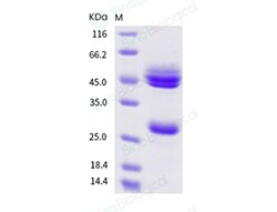 Sino Biological Mouse IL-12 (IL12A & IL12B Heterodimer) Protein (His Tag)