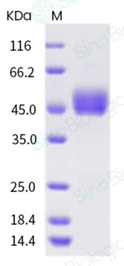 Sino Biological Recombinant Human CD3D & CD3E Heterodimer Protein (ECD,