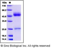 Sino Biological Mouse IL-23 (IL23A & IL12B Heterodimer) Protein 50ug, Quantity: