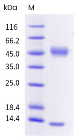 Sino Biological Mouse FCGRT & B2M Heterodimer Protein 1mg, Quantity: Each