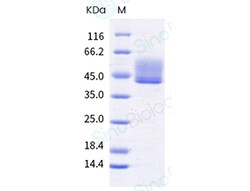 Sino Biological Cynomolgus CD3D & CD3E Heterodimer Protein (Fc-Flag & Fc-His