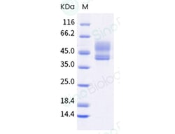 Sino Biological Recombinant Cynomolgus CD3D & CD3E Heterodimer Protein
