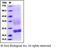 Sino Biological Mouse CD3D & CD3E Heterodimer Protein 50ug, Quantity: Each