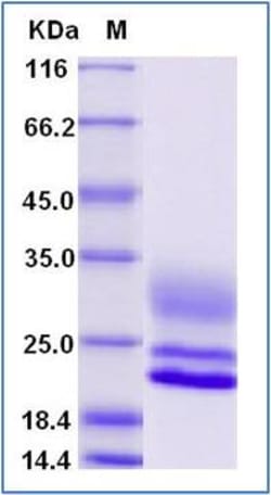 Sino Biological Human CD3D & CD3E Heterodimer Protein (Flag & His Tag)