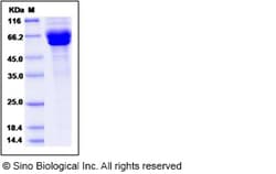 Sino Biological Human IL-35 (IL12A & EBI3 Heterodimer) Protein 500ug, Quantity: