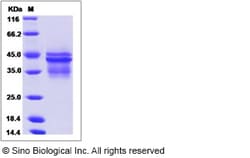 Sino Biological Rhesus IL-12 (IL12A & IL12B Heterodimer) Protein 20ug,