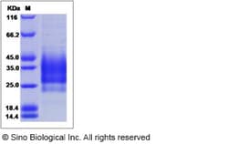 Sino Biological Mouse CD79 (CD79A & CD79B Heterodimer) Protein (His Tag)