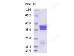 Sino Biological Recombinant Human IL17A & IL17F Heterodimer Protein (His
