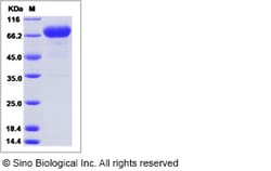 Sino Biological Recombinant Human Neurotrophin 3/NT-3 Protein, Quantity: