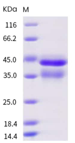 Sino Biological Human IL-12 (IL12A & IL12B Heterodimer) Protein 10ug, Quantity: