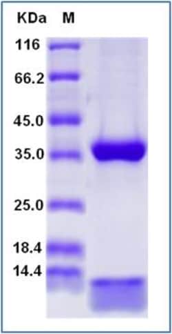 Sino Biological Recombinant Human FCGRT & B2M Heterodimer Protein (His