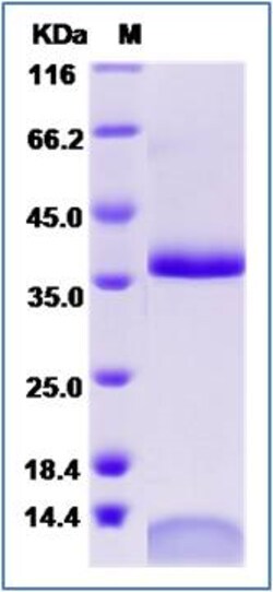 Sino Biological Recombinant Human FCGRT & B2M Heterodimer Protein (His