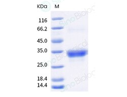 Sino Biological Recombinant Cynomolgus CD8A & CD8B Heterodimer Protein